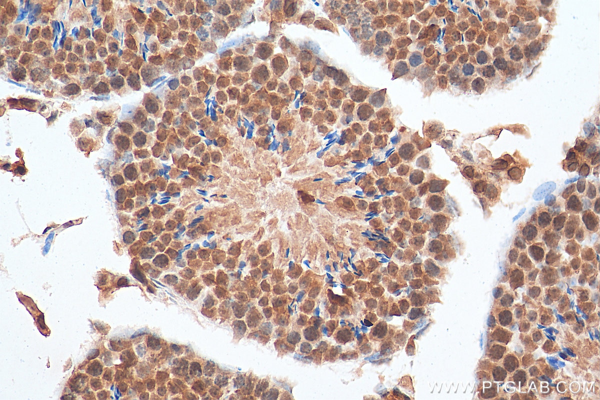 Immunohistochemistry (IHC) staining of mouse testis tissue using TXNRD3 Polyclonal antibody (19517-1-AP)