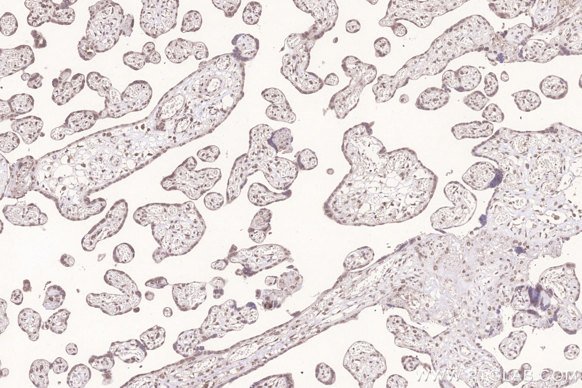 Immunohistochemistry (IHC) staining of human placenta tissue using TXNRD3 Polyclonal antibody (19517-1-AP)