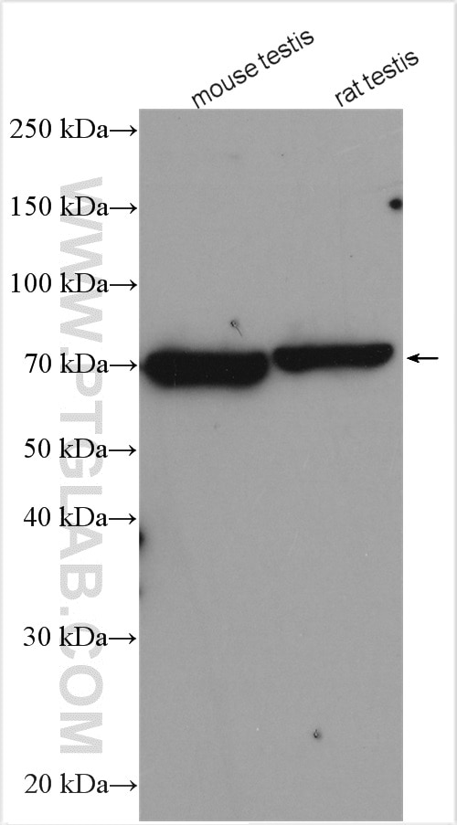 Western Blot (WB) analysis of various lysates using TXNRD3 Polyclonal antibody (19517-1-AP)