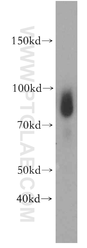 Western Blot (WB) analysis of human testis tissue using TXNRD3 Polyclonal antibody (19517-1-AP)