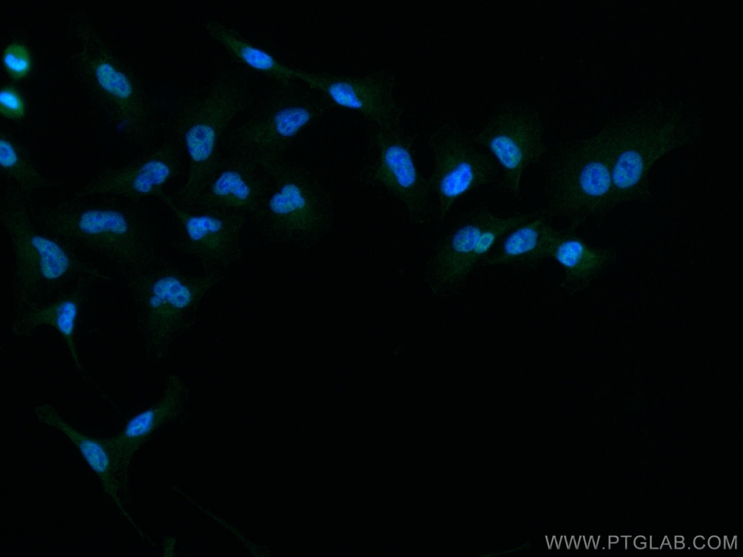 Immunofluorescence (IF) / fluorescent staining of A549 cells using TYK2 Polyclonal antibody (16412-1-AP)