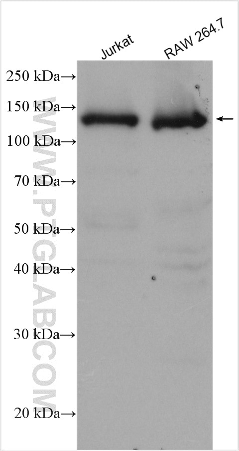 Western Blot (WB) analysis of various lysates using TYK2 Polyclonal antibody (16412-1-AP)