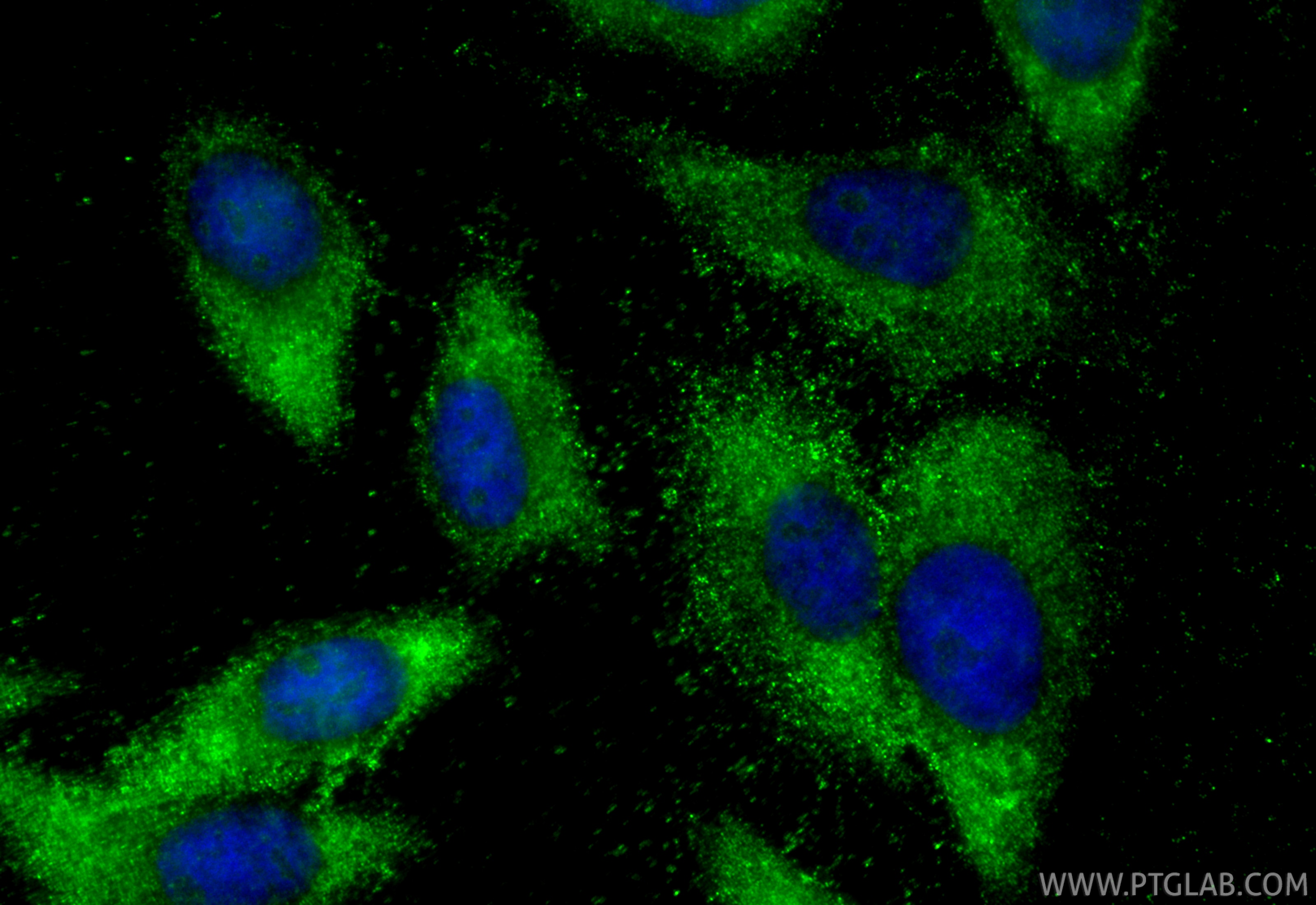 IF Staining of HepG2 using 30838-1-AP Immunofluorescence (IF) / fluorescent staining of HepG2 cells using TYK2 Polyclonal antibody (30838-1-AP)