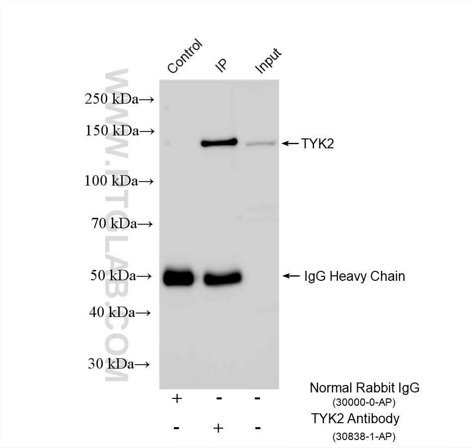 Immunoprecipitation (IP) experiment of HepG2 cells using TYK2 Polyclonal antibody (30838-1-AP)