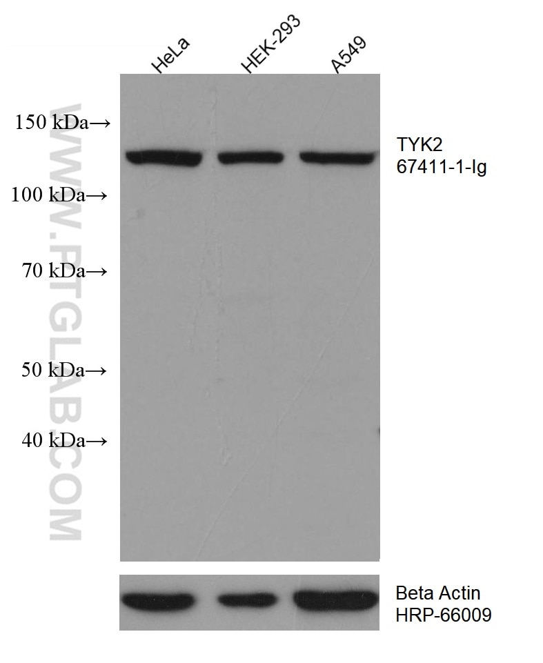 Western Blot (WB) analysis of various lysates using TYK2 Monoclonal antibody (67411-1-Ig)