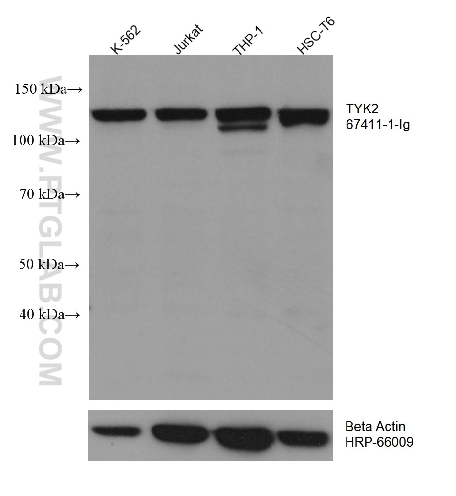 Western Blot (WB) analysis of various lysates using TYK2 Monoclonal antibody (67411-1-Ig)