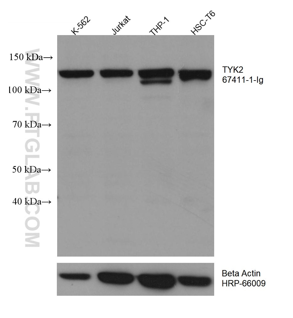 WB analysis using 67411-1-Ig