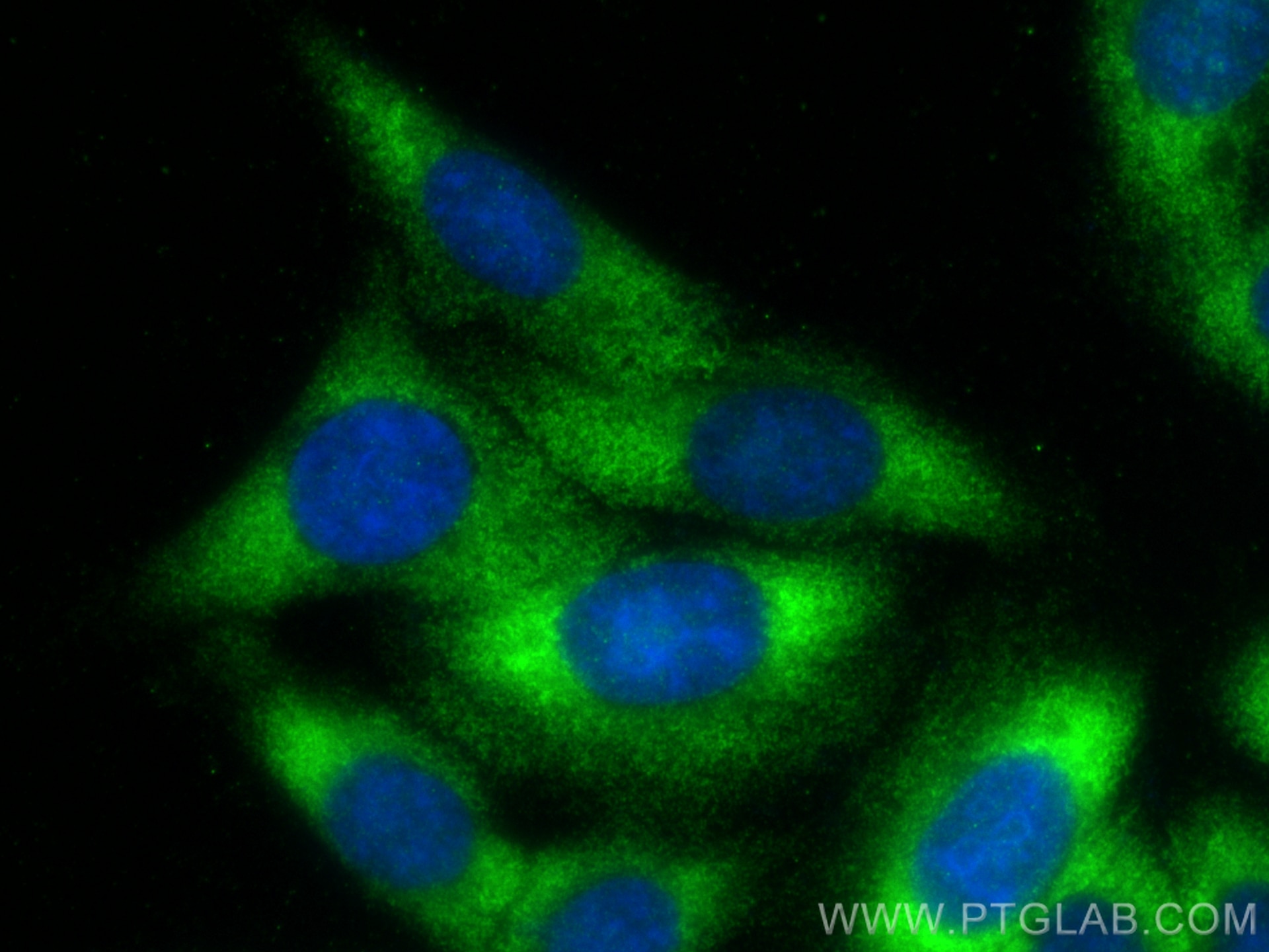 Immunofluorescence (IF) / fluorescent staining of HepG2 cells using TYK2 Recombinant antibody (83161-4-RR)