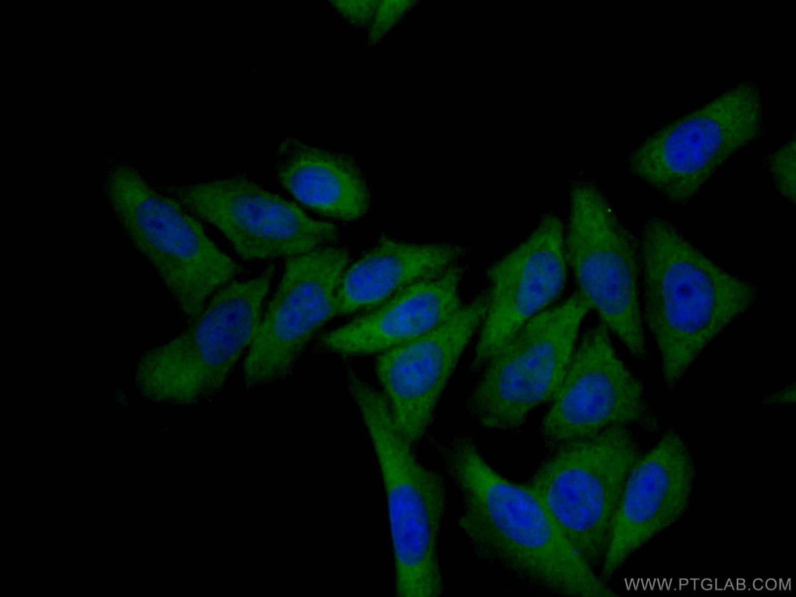 Immunofluorescence (IF) / fluorescent staining of HepG2 cells using Thymidylate synthase Polyclonal antibody (15047-1-AP)