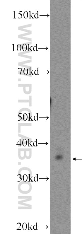 Western Blot (WB) analysis of NIH/3T3 cells using Thymidylate synthase Polyclonal antibody (15047-1-AP)