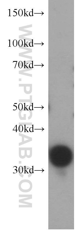 Thymidylate synthase Polyclonal antibody