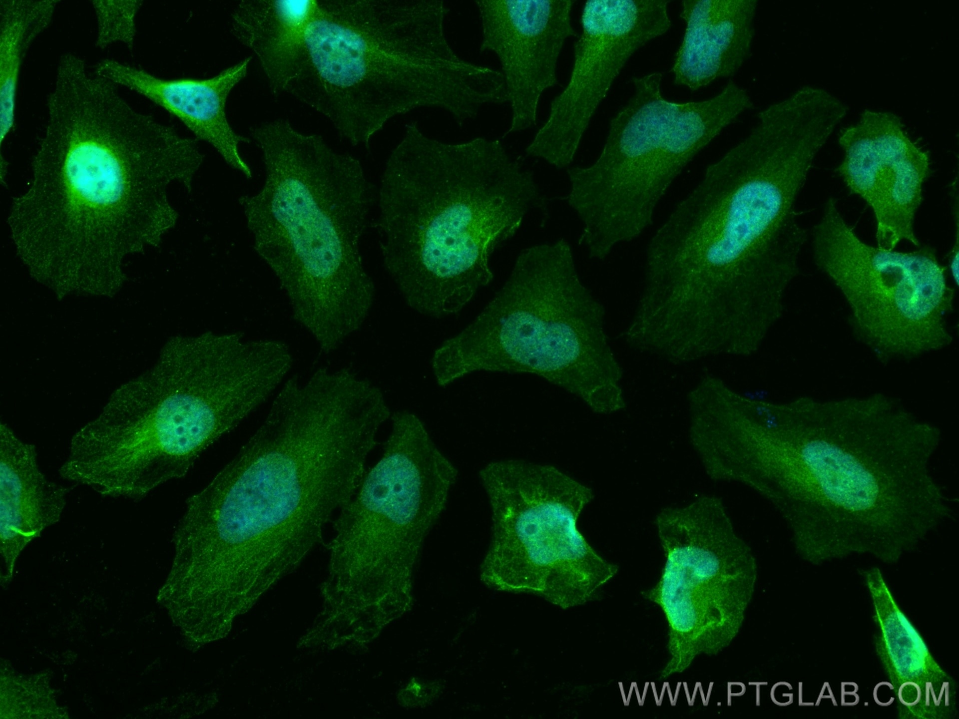Immunofluorescence (IF) / fluorescent staining of HeLa cells using TYMS Monoclonal antibody (66725-1-Ig)