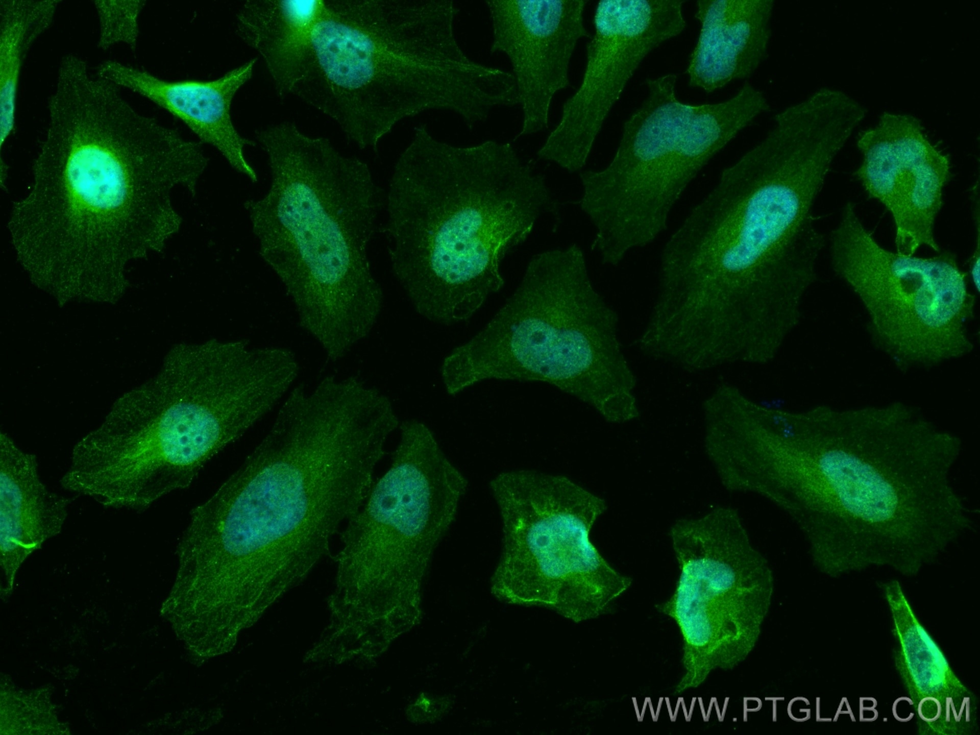 IF Staining of HeLa using 66725-1-Ig