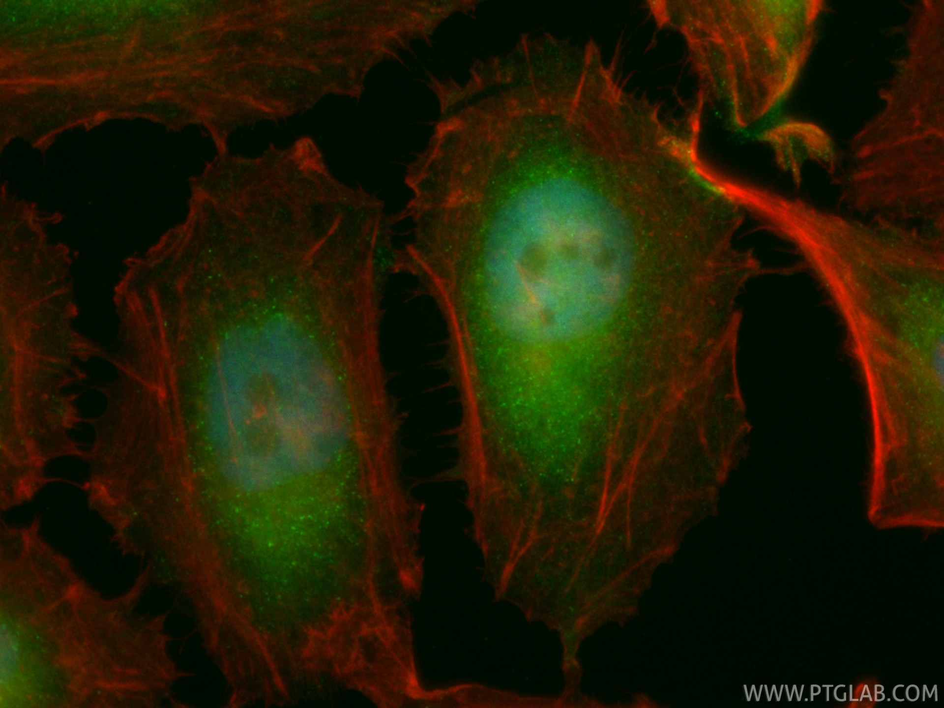 IF Staining of HeLa using CL488-86643 Immunofluorescence (IF) / fluorescent staining of HeLa cells using CoraLite® Plus 488-conjugated TYMS Recombinant mon (CL488-86643)
