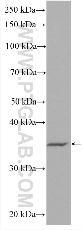 WB analysis of Jurkat using HRP-66725