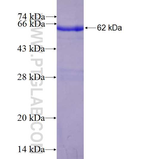 TYMS fusion protein Ag7027 SDS-PAGE