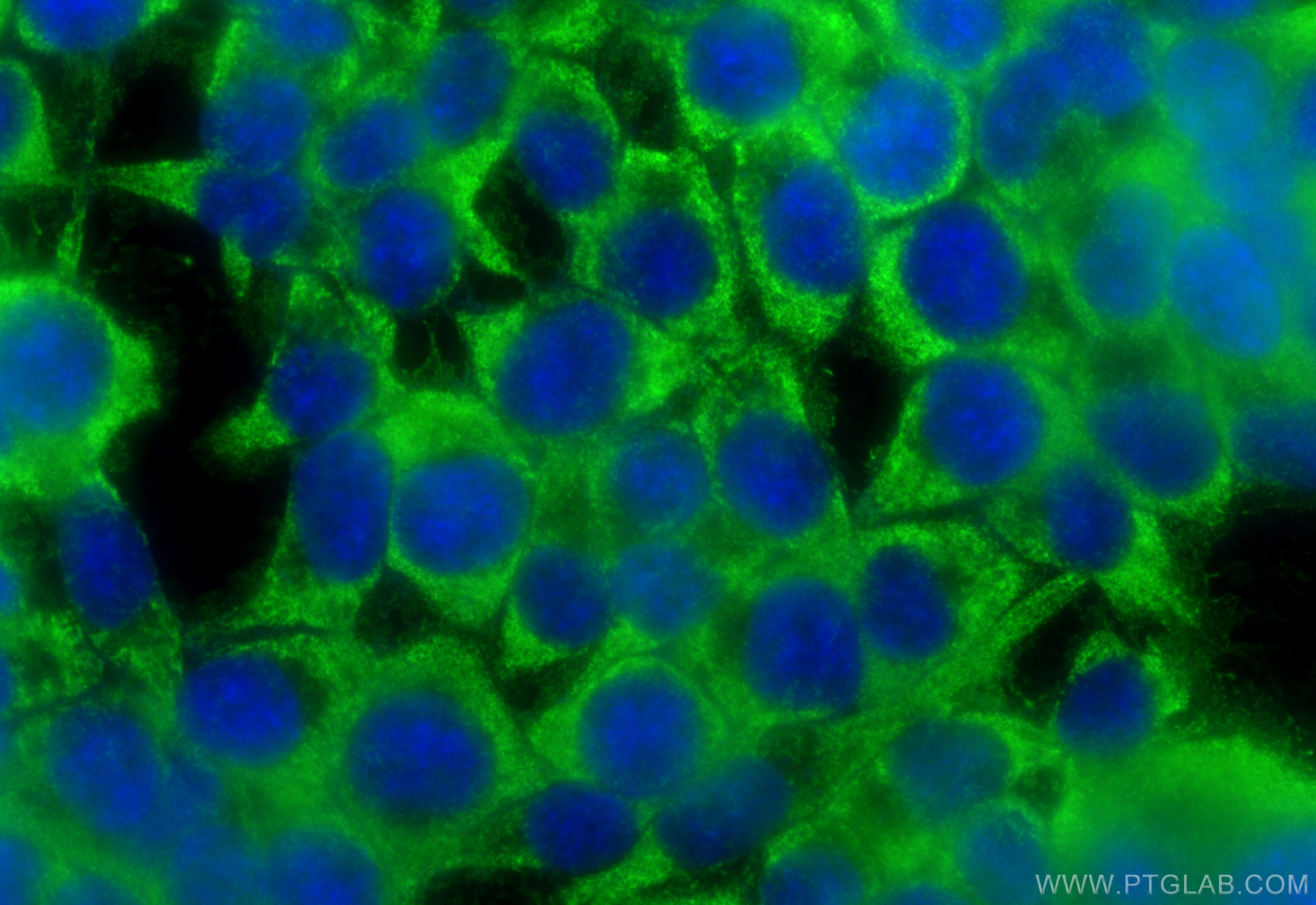 Immunofluorescence (IF) / fluorescent staining of HCT 116 cells using TYRO3 Polyclonal antibody (28513-1-AP)