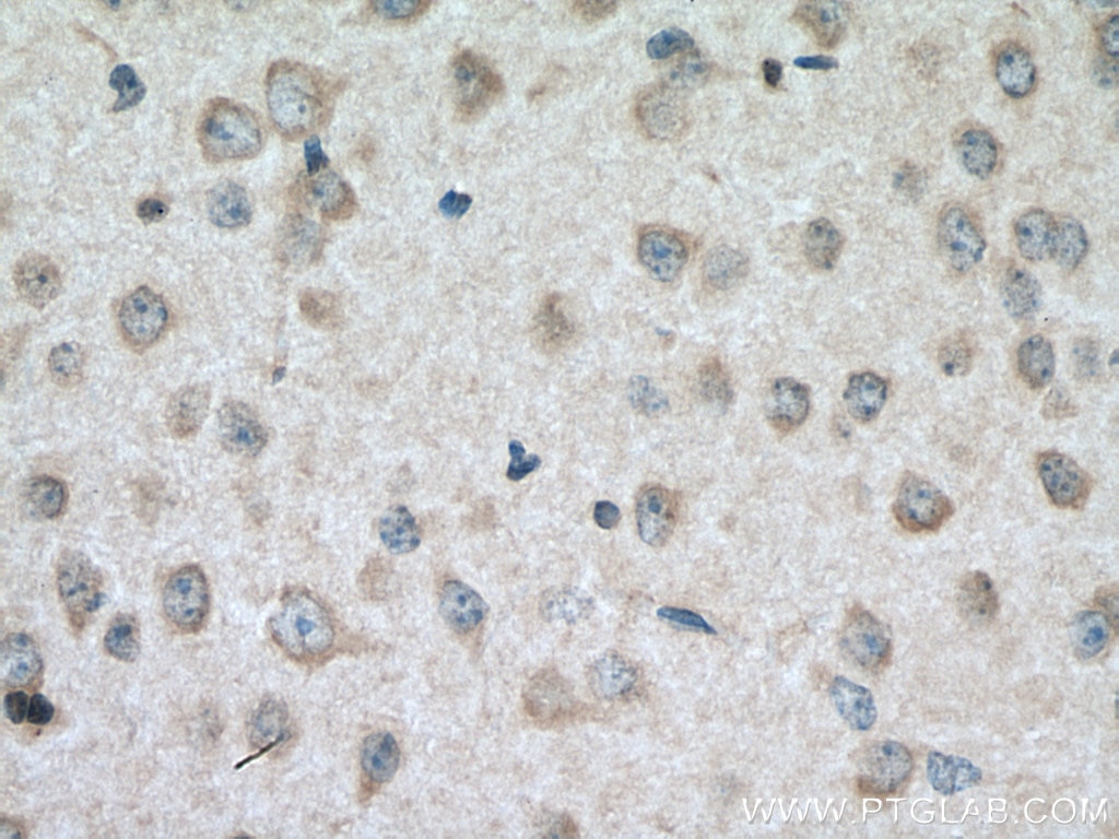 Immunohistochemistry (IHC) staining of mouse brain tissue using TYRO3 Polyclonal antibody (28513-1-AP)