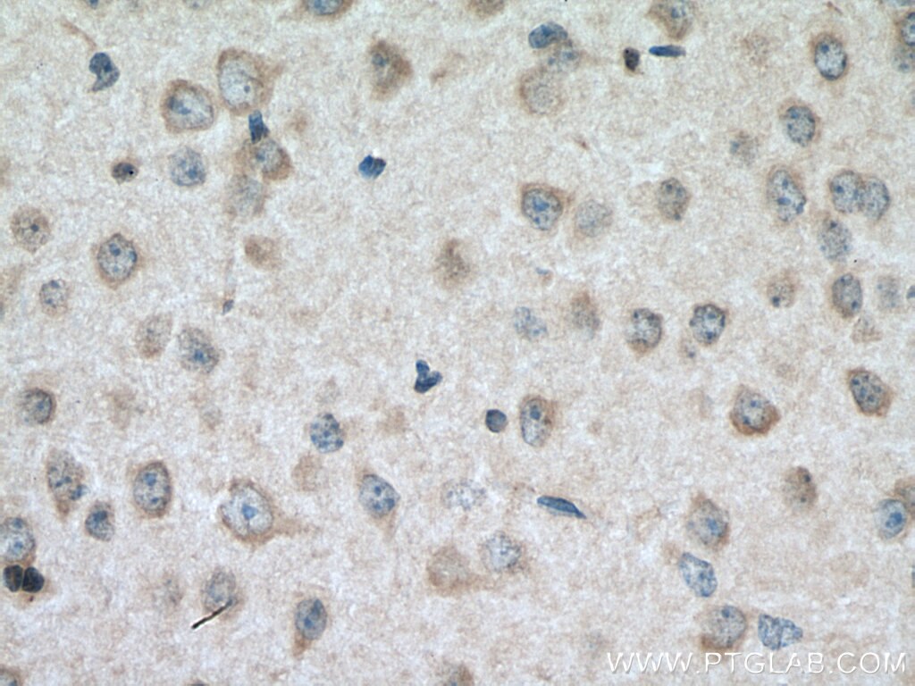 IHC staining of mouse brain using 28513-1-AP