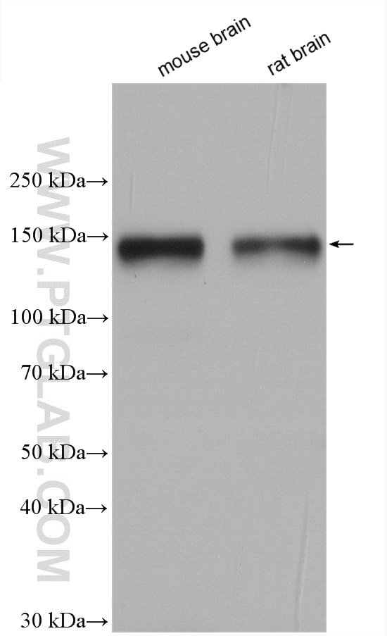 Western Blot (WB) analysis of various lysates using TYRO3 Polyclonal antibody (28513-1-AP)
