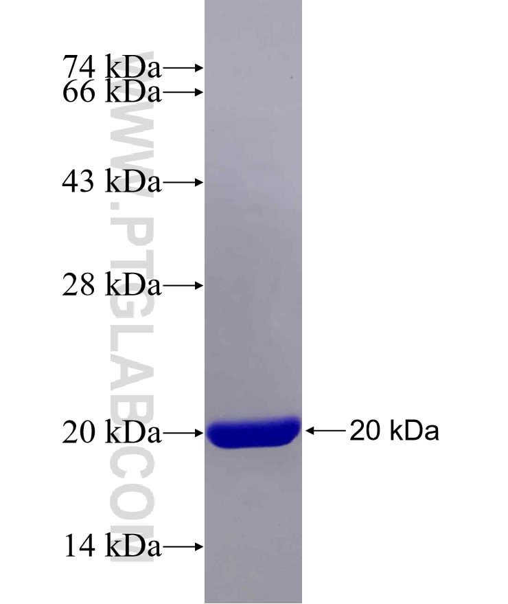 TYRO3 fusion protein Ag29540 SDS-PAGE
