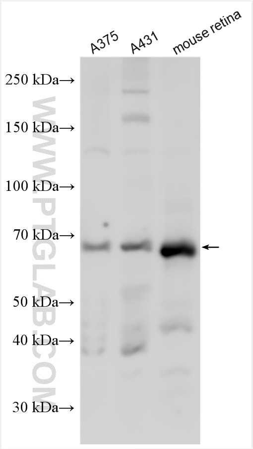 Western Blot (WB) analysis of various lysates using TRP1 Polyclonal antibody (16672-1-AP)