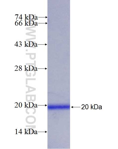 TYRP1 fusion protein Ag26474 SDS-PAGE
