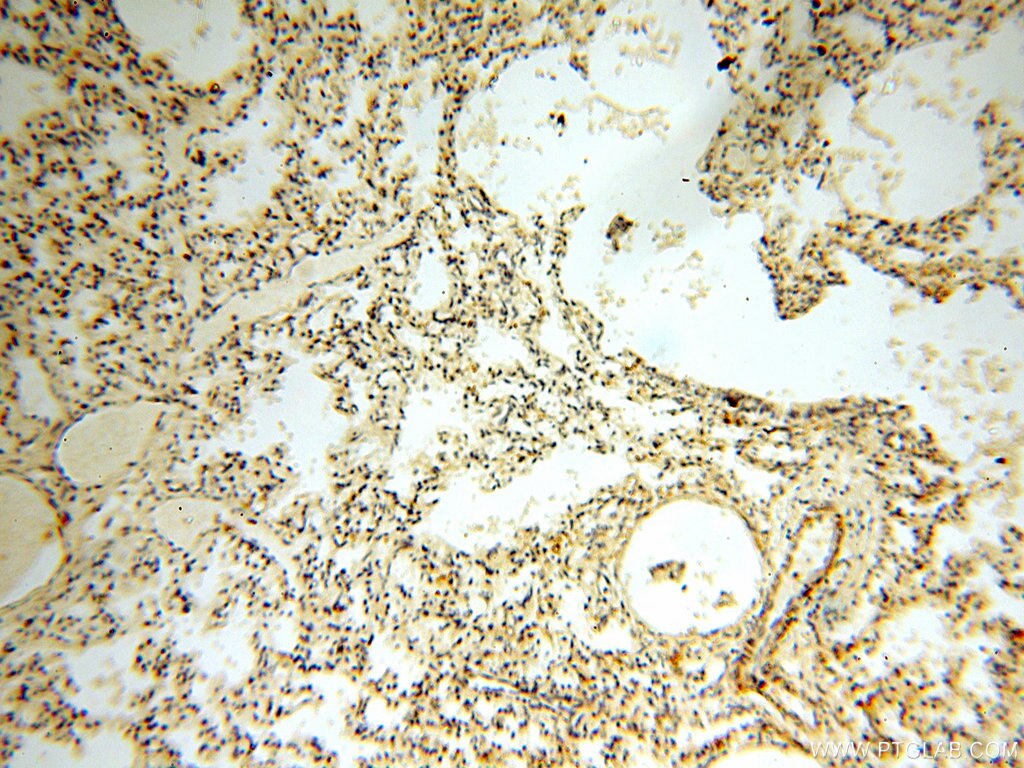 Immunohistochemistry (IHC) staining of human lung tissue using TYW1B Polyclonal antibody (17665-1-AP)