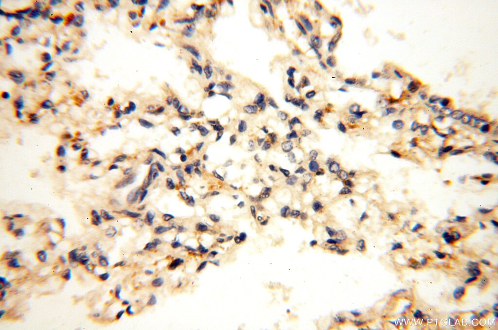 IHC staining of human lung using 17665-1-AP