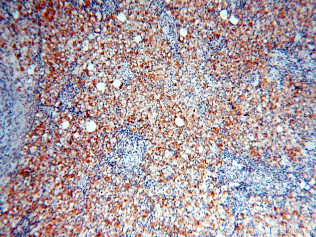 Immunohistochemistry (IHC) staining of human ovary tissue using TYW1B Polyclonal antibody (17665-1-AP)