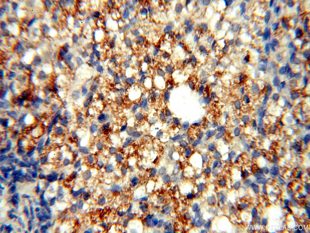 Immunohistochemistry (IHC) staining of human ovary tissue using TYW1B Polyclonal antibody (17665-1-AP)