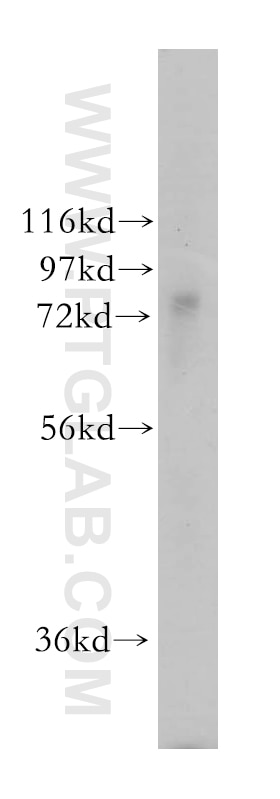 Western Blot (WB) analysis of mouse liver tissue using TYW1B Polyclonal antibody (17665-1-AP)