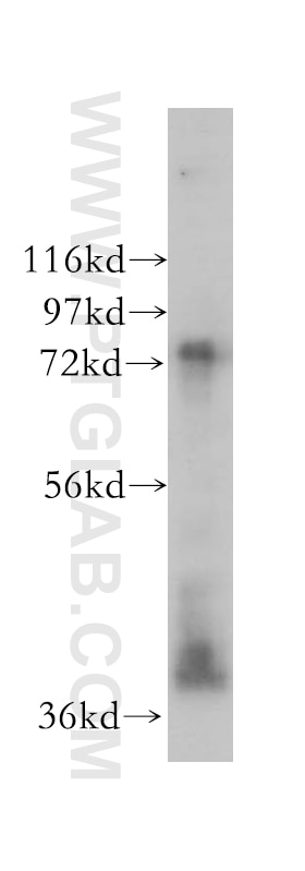 Western Blot (WB) analysis of MCF-7 cells using TYW1B Polyclonal antibody (17665-1-AP)