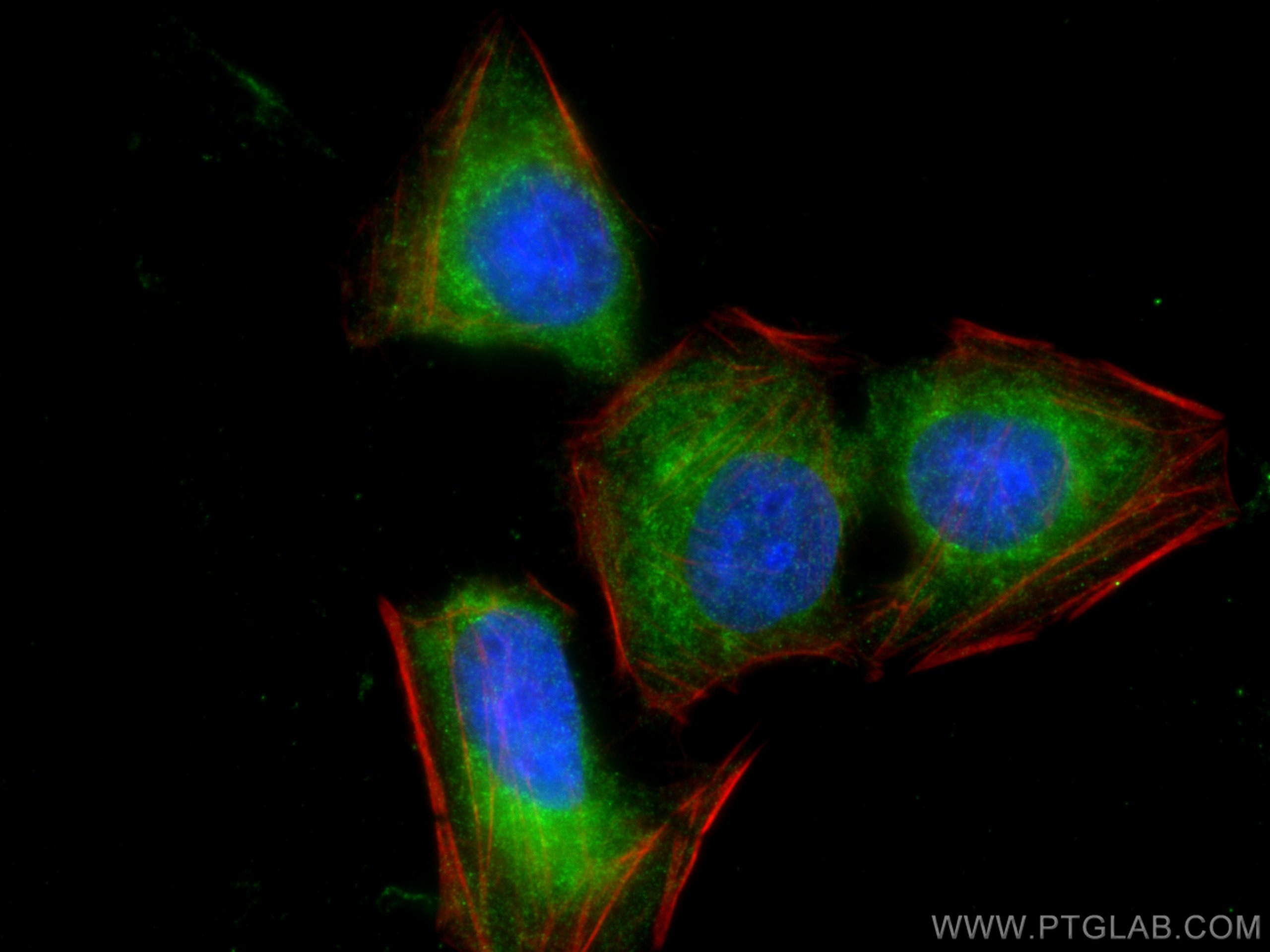 Immunofluorescence (IF) / fluorescent staining of U2OS cells using TYW3 Polyclonal antibody (29213-1-AP)