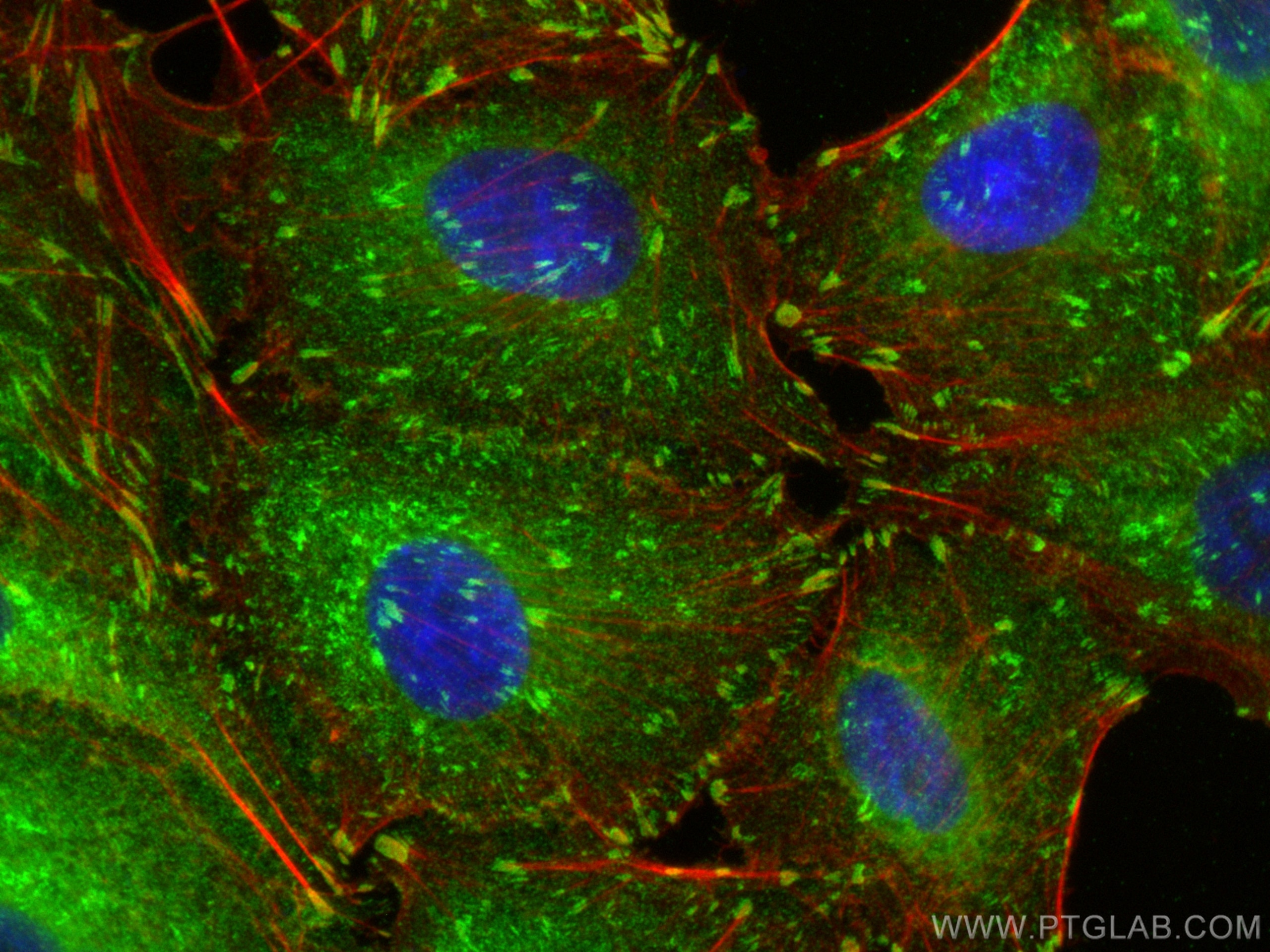 Immunofluorescence (IF) / fluorescent staining of A549 cells using Talin-1 Recombinant antibody (82856-4-RR)