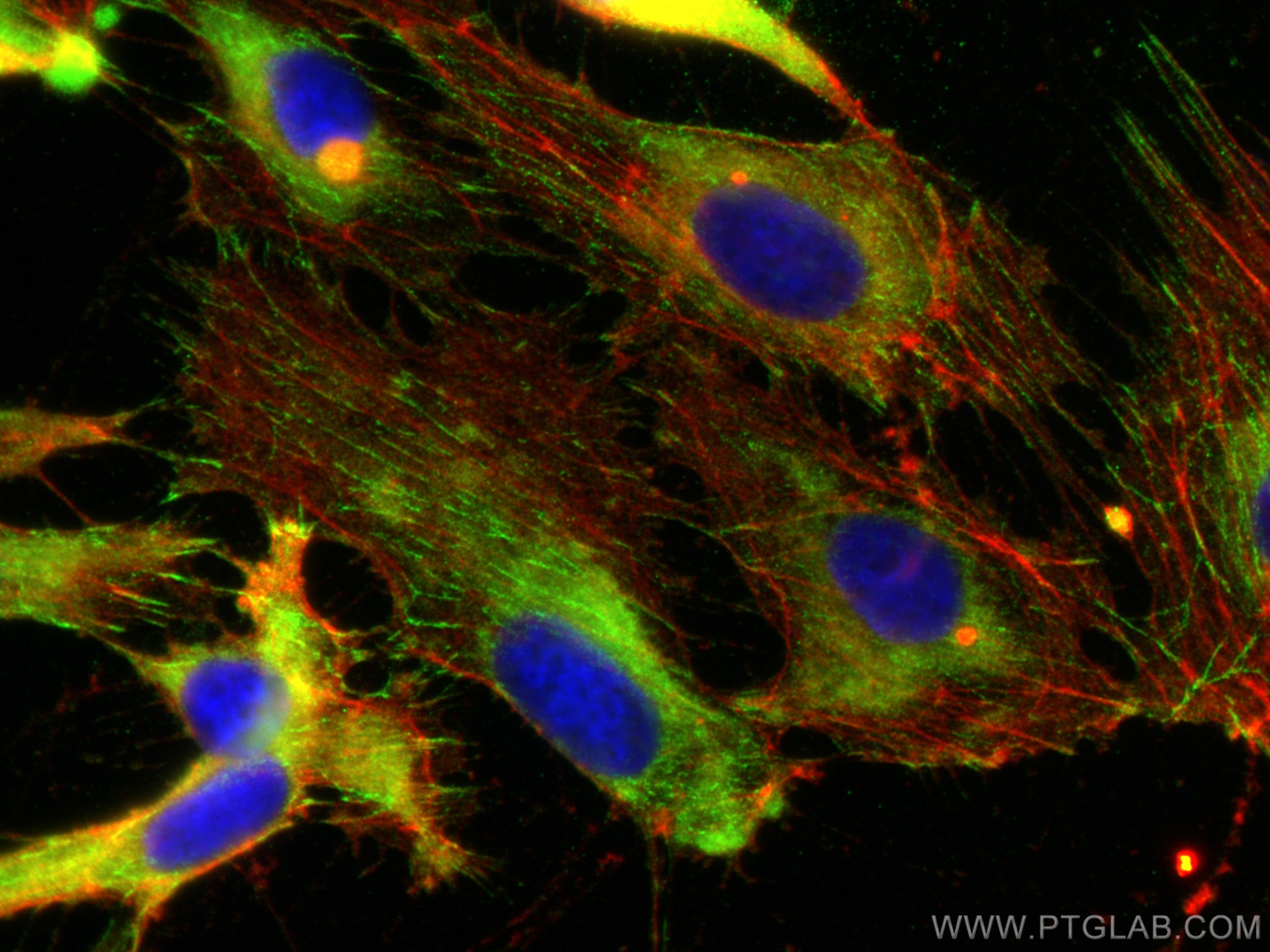Immunofluorescence (IF) / fluorescent staining of HUVEC cells using Talin-1 Recombinant antibody (82856-4-RR)