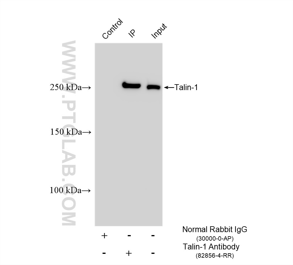 IP result of anti-Talin-1 (IP:82856-4-RR, 4ug; Detection:82856-4-RR 1:3000) with HeLa cells lysate 1120 ug. Immunoprecipitation (IP) experiment of HeLa cells using Talin-1 Recombinant monoclonal antibody (82856-4-RR)