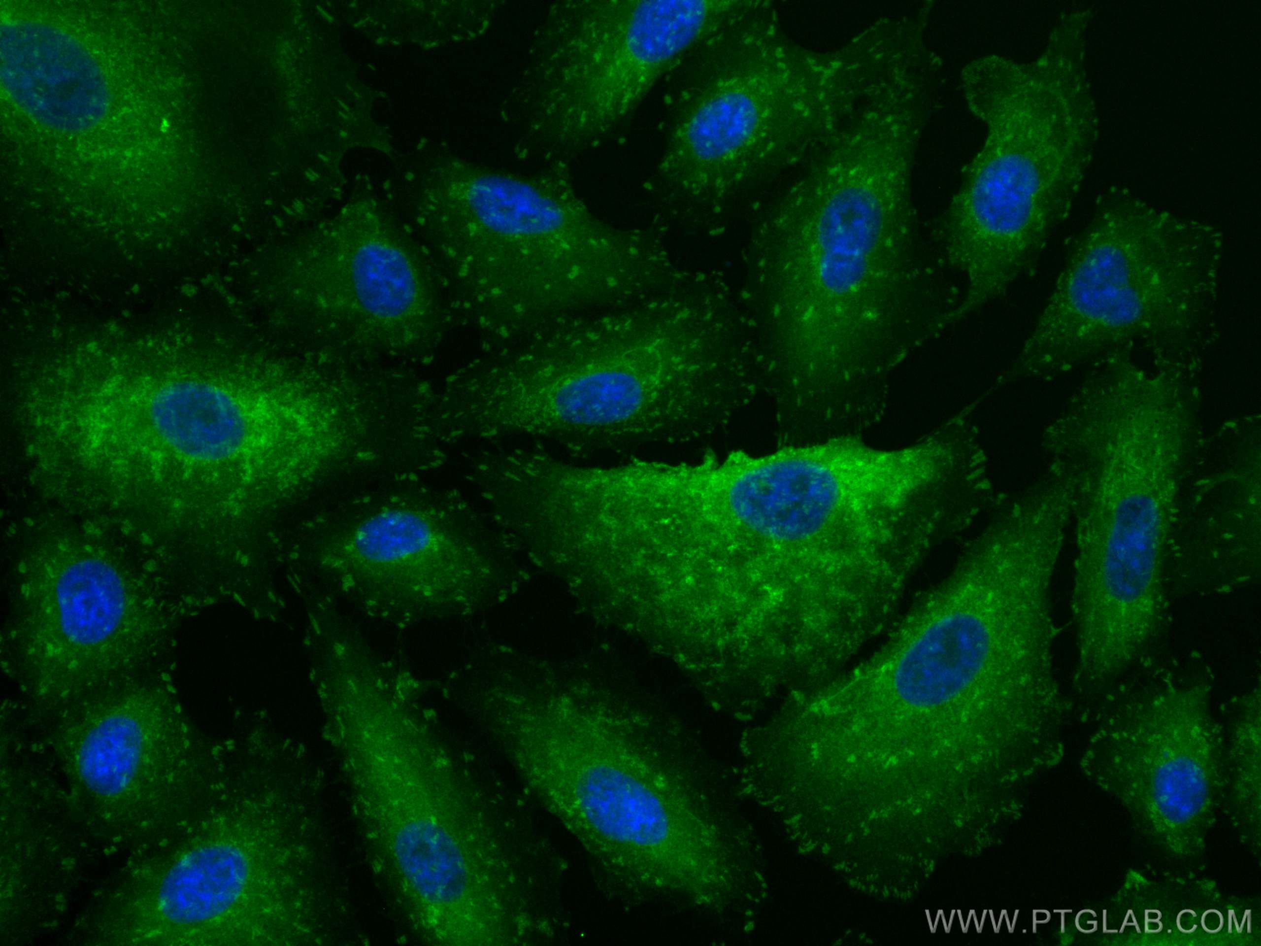 Immunofluorescence (IF) / fluorescent staining of A549 cells using CoraLite® Plus 488-conjugated Talin-1 Polyclonal a (CL488-14168)