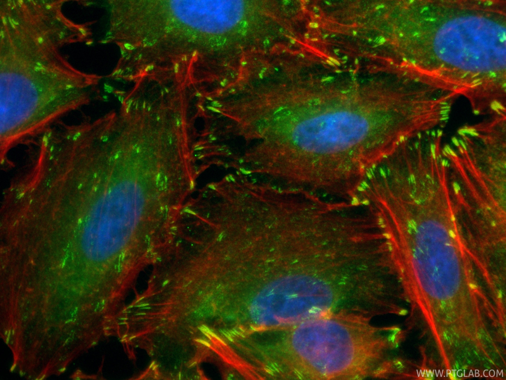 Immunofluorescent analysis of (4% PFA) fixed A549 cells using CoraLite® Plus 488 Talin-1 antibody (CL488-82856-4, Clone: 7D11 ) at dilution of 1:200, CL594-phalloidin (red). Immunofluorescence (IF) / fluorescent staining of A549 cells using CoraLite® Plus 488-conjugated Talin-1 Recombinant (CL488-82856-4)