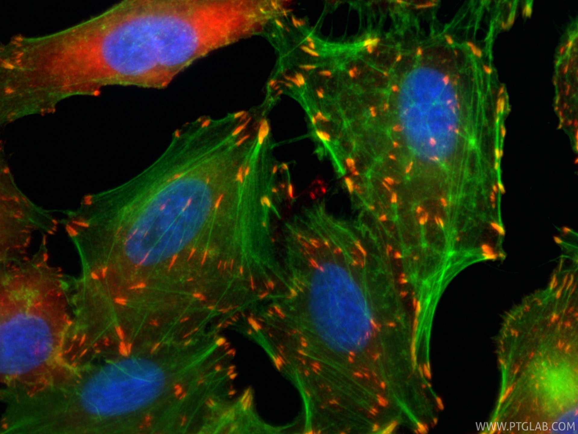 Immunofluorescent analysis of (4% PFA) fixed A549 cells using CoraLite®594 Talin-1 antibody (CL594-82856-4, Clone: 7D11 ) at dilution of 1:200, CL488-phalloidin (green). Immunofluorescence (IF) / fluorescent staining of A549 cells using CoraLite®594-conjugated Talin-1 Recombinant monocl (CL594-82856-4)
