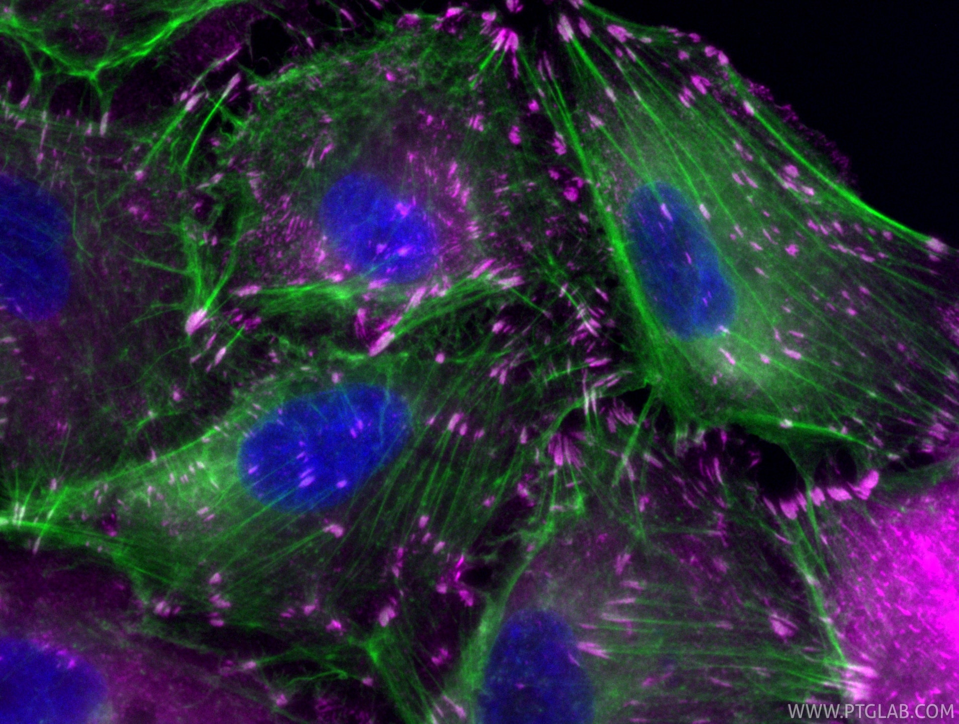 Immunofluorescent analysis of (4% PFA) fixed A549 cells using CoraLite® Plus 647 Talin-1 antibody (CL647-82856-4, Clone: 7D11 ) at dilution of 1:200, CL488-phalloidin (green). Immunofluorescence (IF) / fluorescent staining of A549 cells using CoraLite® Plus 647-conjugated Talin-1 Recombinant (CL647-82856-4)