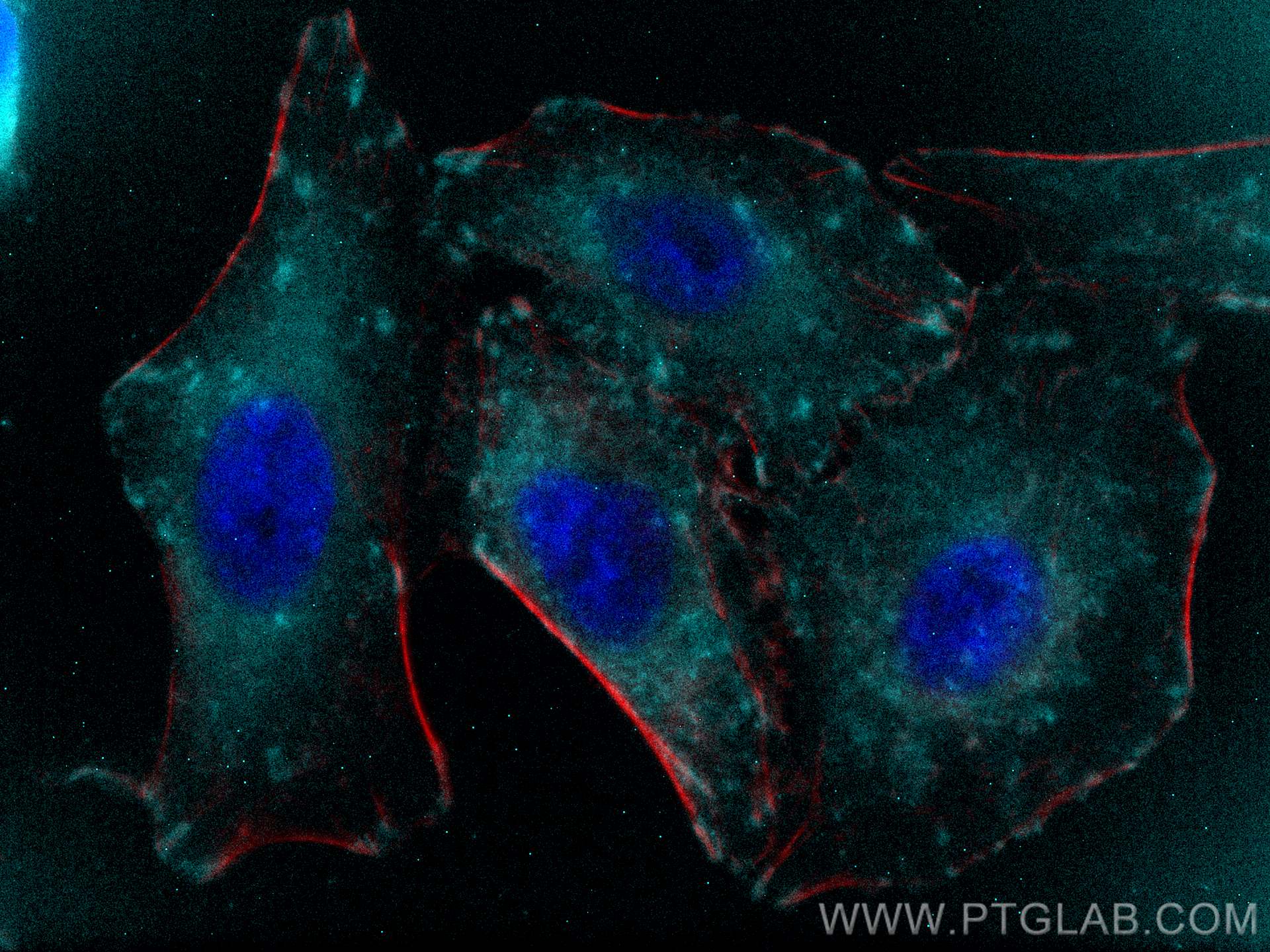 Immunofluorescence (IF) / fluorescent staining of A549 cells using CoraLite® Plus 750-conjugated Talin-1 Polyclonal a (CL750-14168)