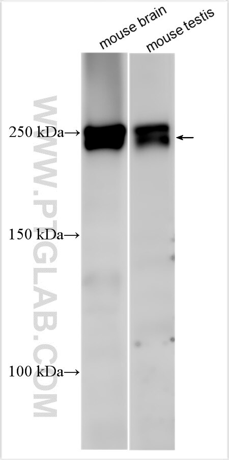 Western Blot (WB) analysis of various lysates using Teneurin-3 Polyclonal antibody (31971-1-AP)