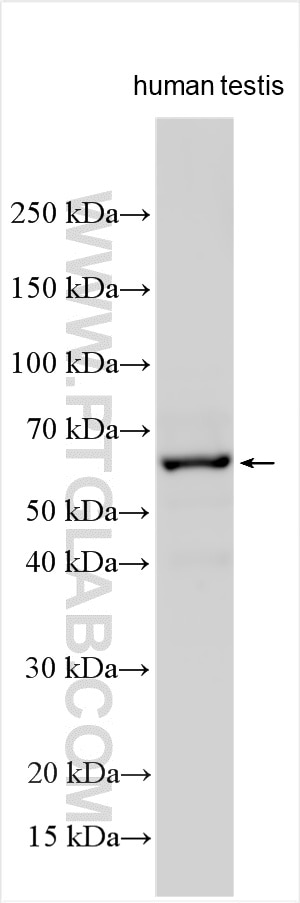 Western Blot (WB) analysis of various lysates using Tesmin Polyclonal antibody (33326-1-AP)