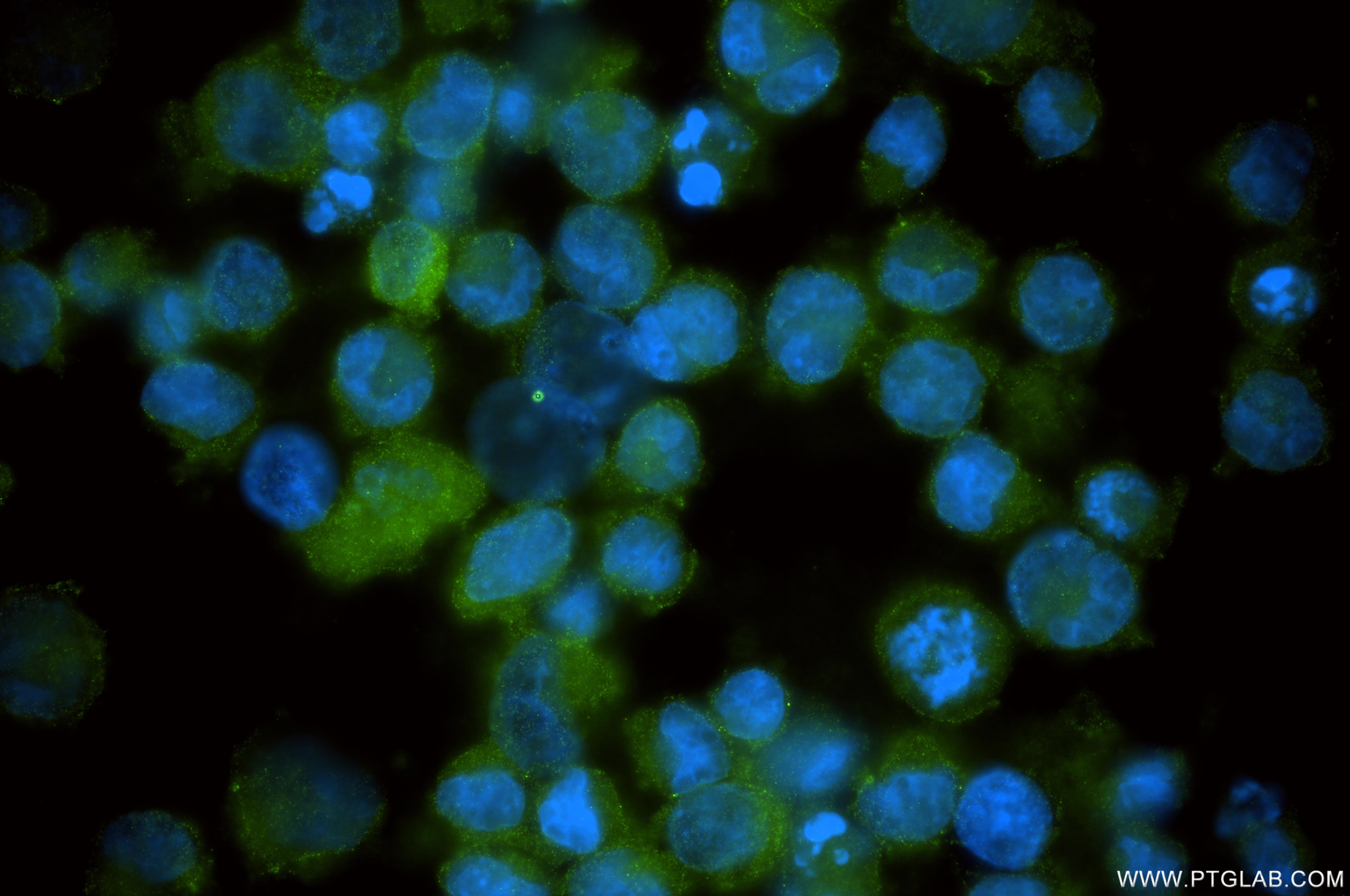 IF Staining of K-562 using 86013-3-RR (same clone as 86013-3-PBS) Immunofluorescence (IF) / fluorescent staining of K-562 cells using Testin Recombinant monoclonal antibody (86013-3-RR)