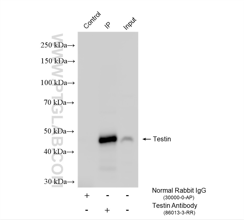 IP experiment of K-562 using 86013-3-RR (same clone as 86013-3-PBS) Immunoprecipitation (IP) experiment of K-562 cells using Testin Recombinant monoclonal antibody (86013-3-RR)
