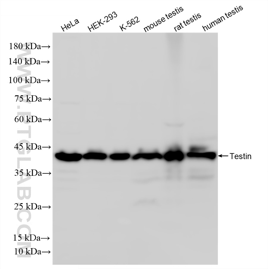 WB analysis using 86013-3-RR (same clone as 86013-3-PBS) Western Blot (WB) analysis of various lysates using Testin Recombinant monoclonal antibody (86013-3-RR)