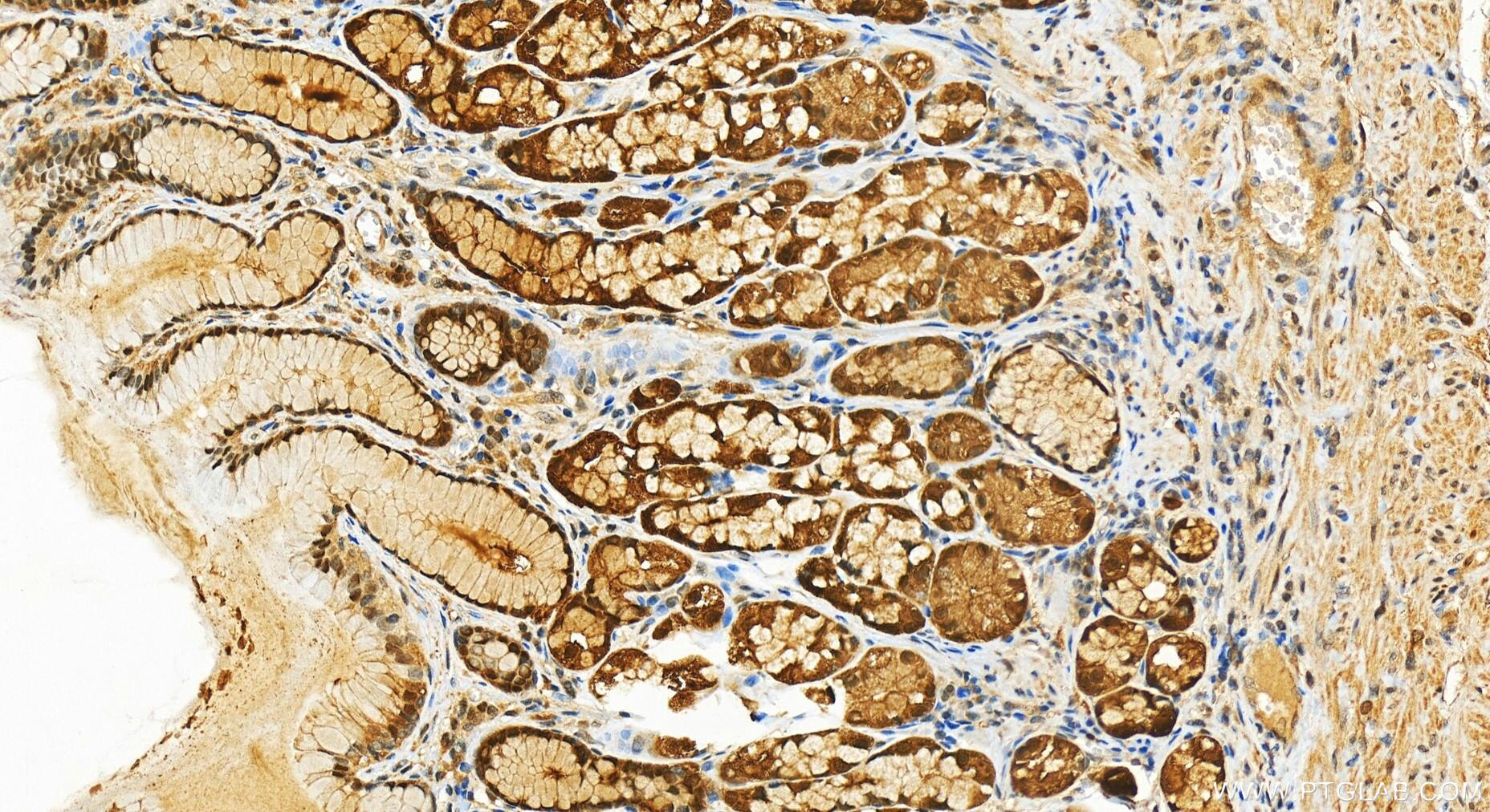 Immunohistochemistry (IHC) staining of human stomach tissue using Thioredoxin Recombinant antibody (82765-1-RR)