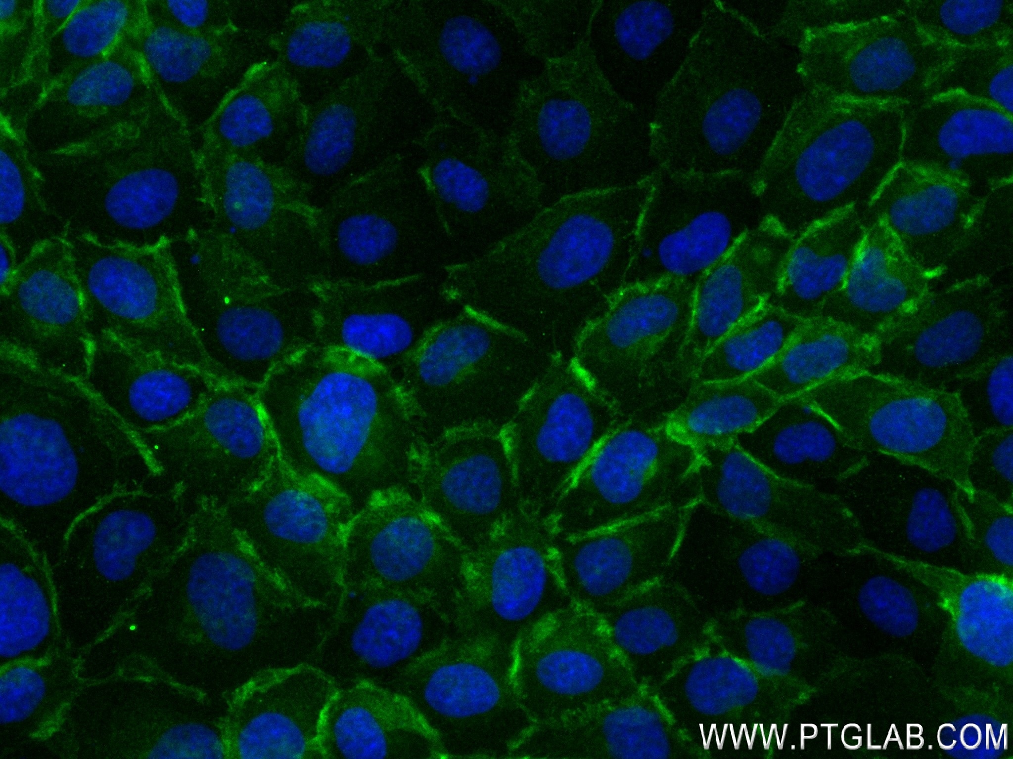 Immunofluorescence (IF) / fluorescent staining of A431 cells using CD141/Thrombomodulin Recombinant antibody (83416-4-RR)