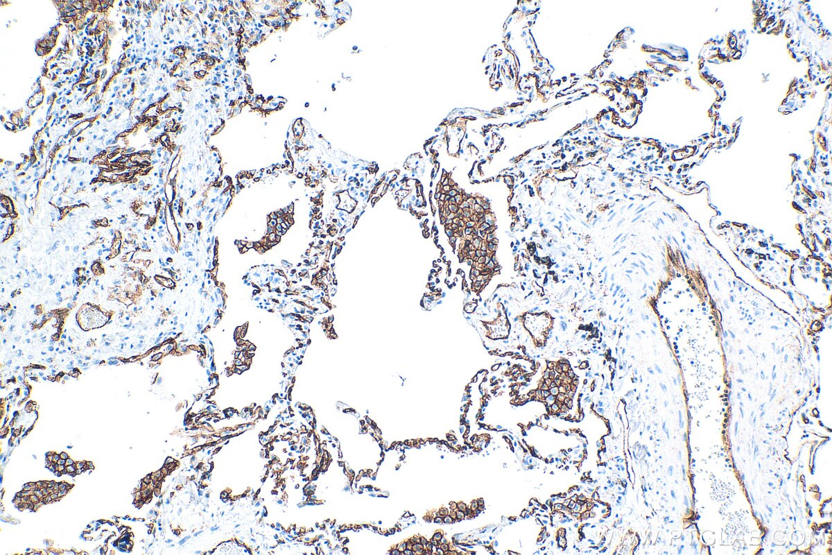 Immunohistochemistry (IHC) staining of human lung tissue using Thrombomodulin Recombinant antibody (83416-4-RR)